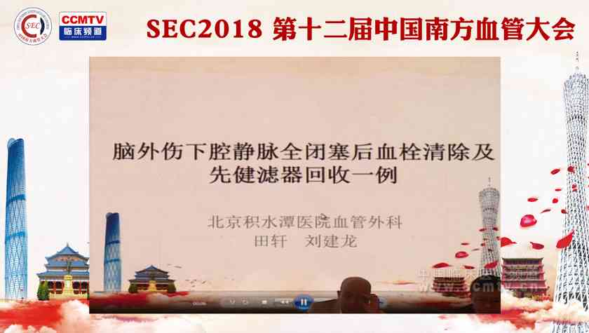 田轩 刘建龙：脑外伤下腔静脉全闭塞后血栓清除及先健滤器回收一例